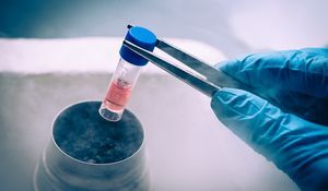 stem-cells stem-cells