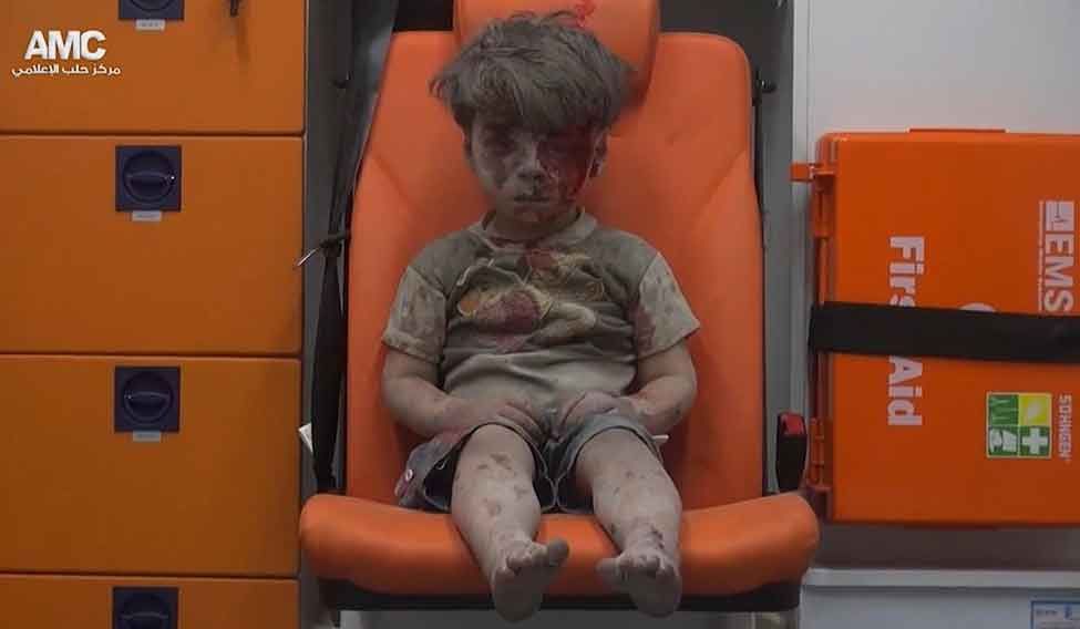 Omran Daqneesh sits in an ambulance after being pulled out or a building hit by an airstirke, in Aleppo, Syria | AP Children of war