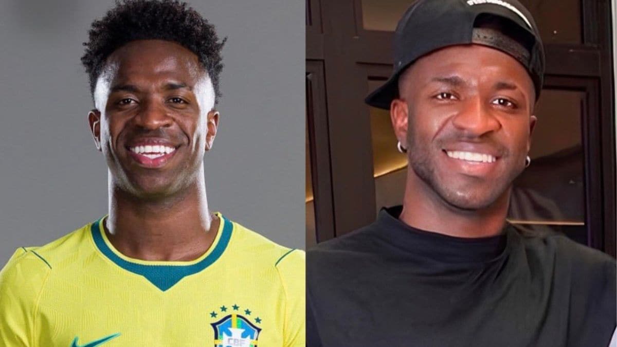 Before and after look of Brazil's Vinícius Júnior after undergoing chin harmonisation surgery | X