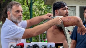 Did RAF use pellet guns on students? CRPF orders inquiry into allegation of personnel using disproportionate force