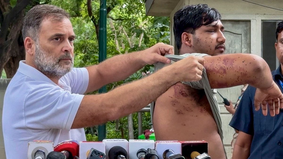 Leader of Opposition in the Lok Sabha Rahul Gandhi along with a victim of alleged pellet gun firing during a students protest march carried out by Cockroach Janata Party (CJP) on July 20 | PTI