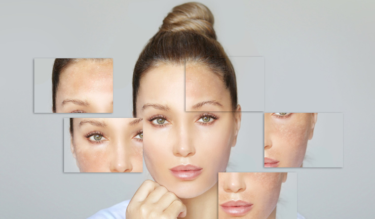 Skin-whitening-hyperpigmentation-shutterstock