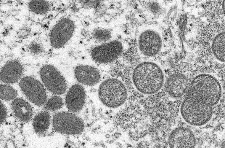 Israel Monkeypox