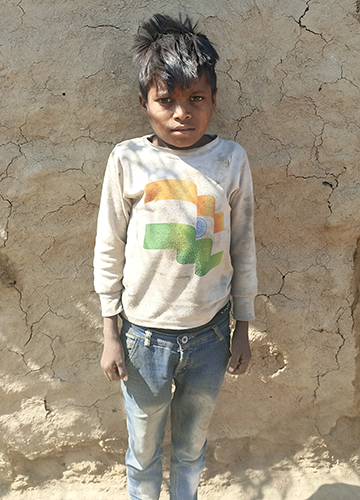 Bhagwan's elder brother Kanu, 16, also has the disease.