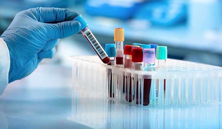 12-Blood-test-to-detect-Alzheimer