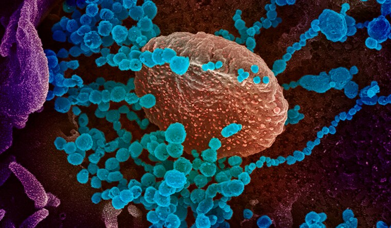 This image obtained March 12, 2020 courtesy of The National Institutes of Health(NIH)/NIAD-RML shows a scanning electron microscope image of SARS-CoV-2 (round blue objects) emerging from the surface of cells cultured in the lab, SARS-CoV-2, also known as 2019-nCoV, is the virus that causes COVID-19, the virus shown was isolated from a patient in the US. - US President Donald Trump announced a shock 30-day ban on travel from mainland Europe over the coronavirus pandemic that has sparked unprecedented lockdowns, widespread panic and another financial market meltdown March 12, 2020. Trump's unexpected move in a primetime TV address from the Oval Office pummelled stock markets, as traders fretted about the economic impact of the outbreak that is on a seemingly relentless march across the planet. (Photo by Handout / National Institutes of Health / AFP) / RESTRICTED TO EDITORIAL USE - MANDATORY CREDIT "AFP PHOTO /NATIONAL INSTITUTES OF HEALTH/NIAD-RML/HANDOUT " - NO MARKETING - NO ADVERTISING CAMPAIGNS - DISTRIBUTED AS A SERVICE TO CLIENTS