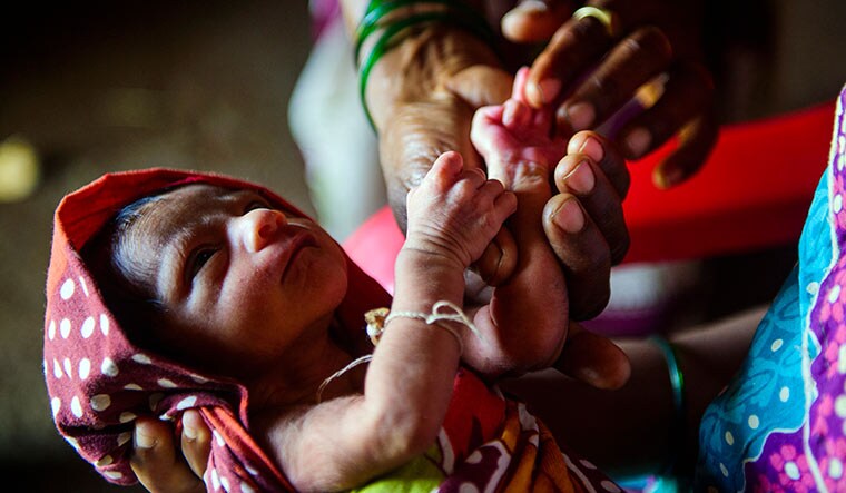 Holding on: A woman from Bahapada, a tribal village in Palghar district of Maharashtra, tends to her underweight grandchild.