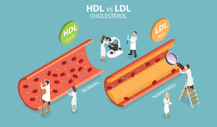 HDL-LDL-HDL-Good-HDL-cholesterol-high-density-lipoprotein-LDL