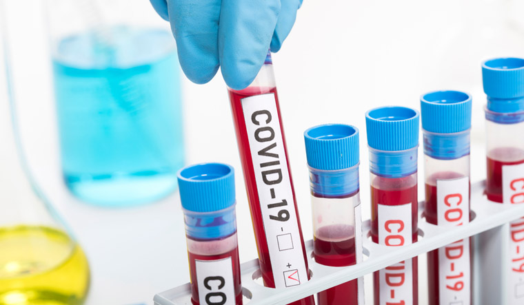 Microbiologist-lab--biological-sample-Coronavirus-Covid-19-shut