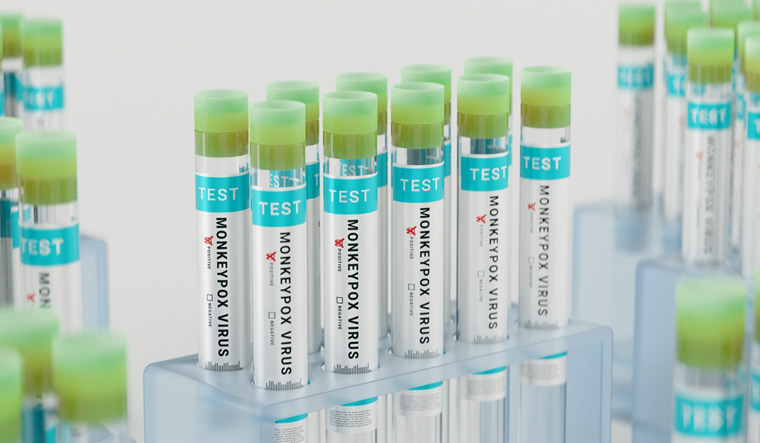 Monkeypox-virus-test-tubes-vial-rack-healthcare-laboratory-postive-test-resul-pandemic-shuy