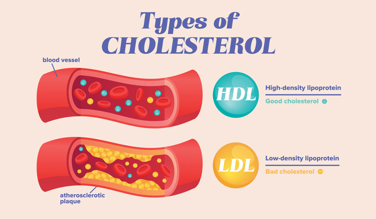 cholesterol-HDL-LDL-Good-HDL-cholesterol-high-density-lipoprotein-LDL