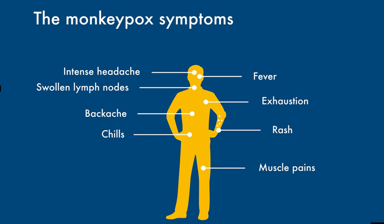 monkeypox-symptoms-graphics-