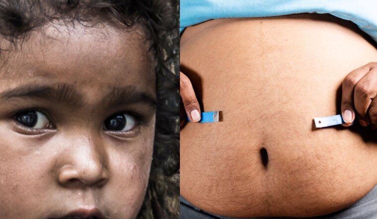 poverty-obesity-poor-rich-shut