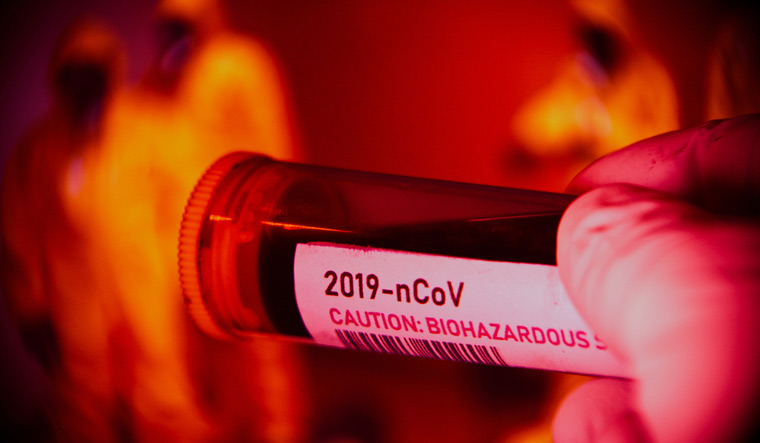 2019-nCoV-Corona-virus-blood-test-sample-Protective-suits-respiratory-syndrome-Wuhan-shut
