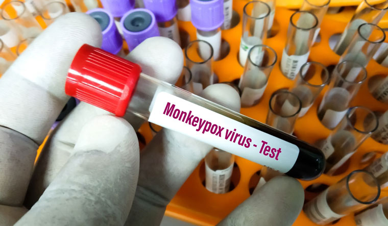 Monkeypox-Virus-Monkey-pox-virus-shut