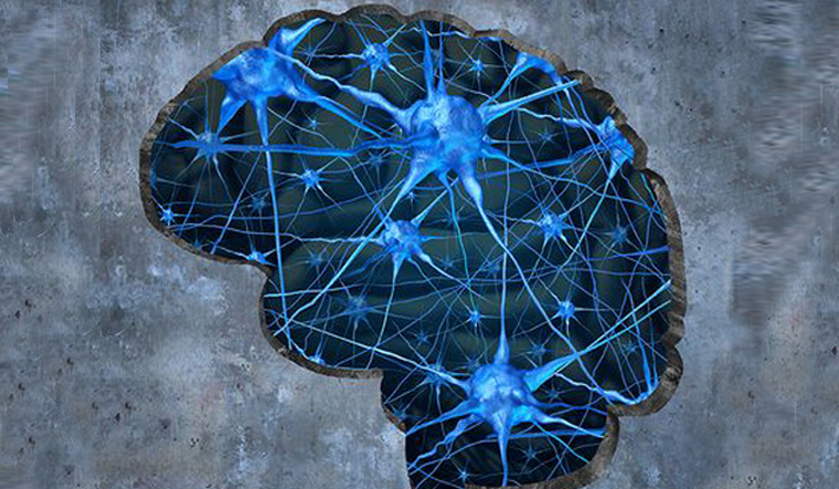 dementia-brain-prevent-dementia-memory