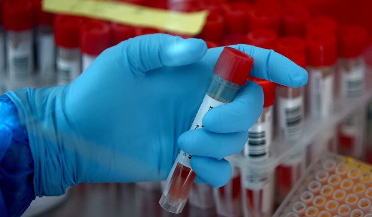HEALTH-CORONAVIRUS/AUSTRIA