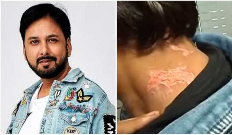 Shehbaz Badesha tattoos Shehnaaz Gill's name, Sidharth Shukla face on his  arm, see pic and video - Hindustan Times