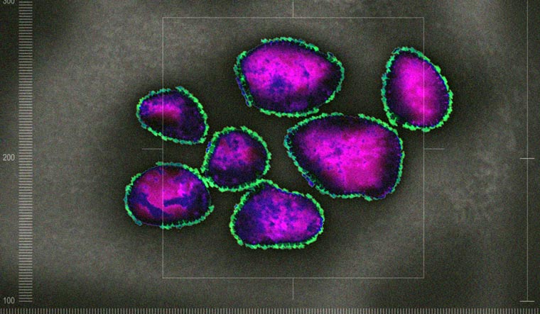 Coronavirus--COVID-19-under-microscope-shut