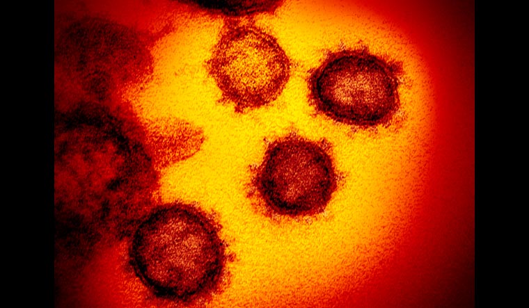 Virus Outbreak-New Testing Option