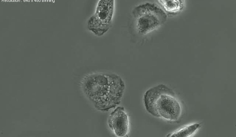 brucella-bacterium-wikimedia