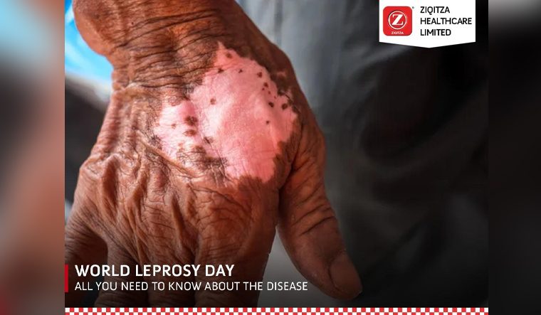 World-Leprosy-Day