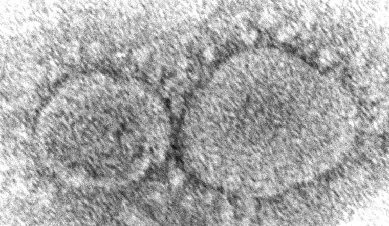 Covid virus may stay in human body for over a year: Study