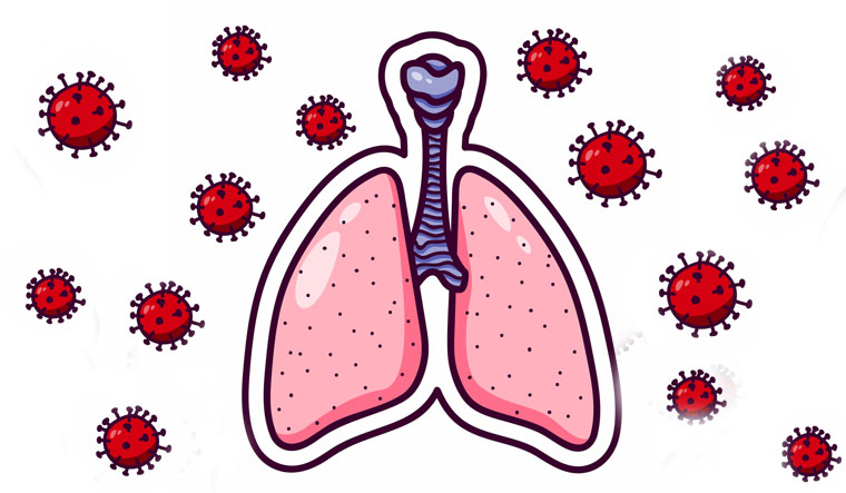 Red-bacteriophage-coronavirus-Lungs-covid-lungs-illustration-shut