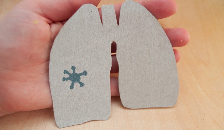 covid-19-lungs-coronavirus-patient-health-shut