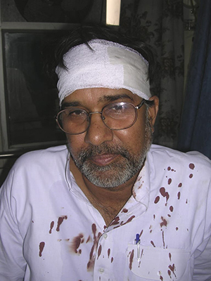 Kailash Satyarthi suffered head injury during the operation