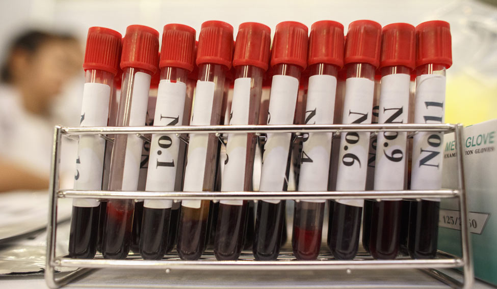 blood-test-rep-reuters