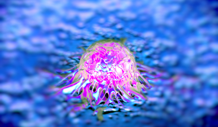 prostate-cancer-tumour-cell-shut