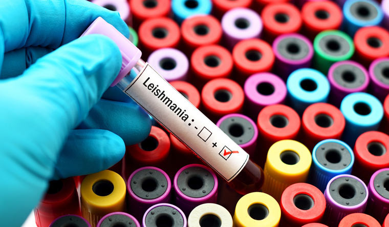 Blood-sample-positive-with-Leishmania-parasite-test-Shut