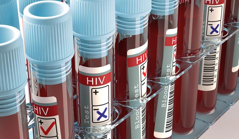 medical-lab-HIV-aids-postive-test-blood-samples-shut