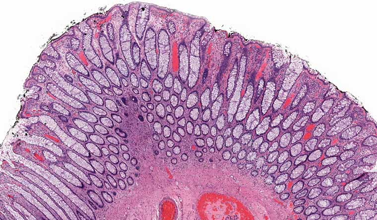 microscopic-view-cross-section-human-tissue-shut
