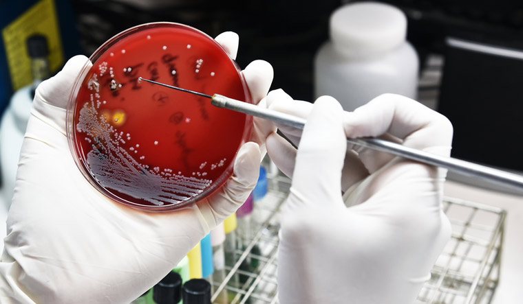 bacteria-culture-laboratory-shut