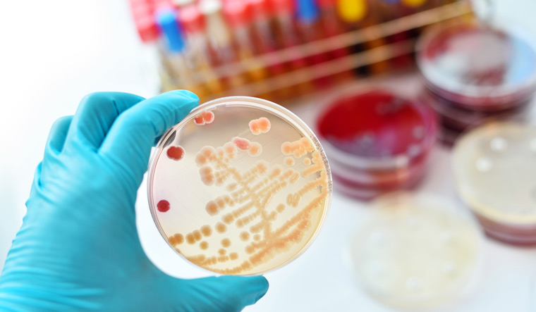 Colonies-of-bacteria-in-petri-dish-shut