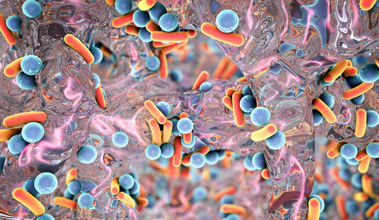 Biofilm-of-antibiotia-resistant-bacteria