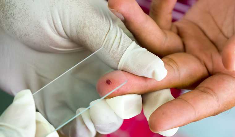 blood-films-for-malaria-parasites-on-fingers-blood-test-glass-diagnosis-shut