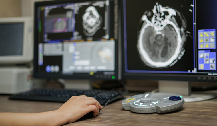 medical-ct-scan-control-room-workstation-CT-brain-image