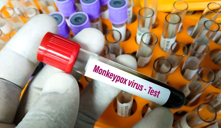 Blood-sample-tube-for-Monkeypox-virus-test-shut