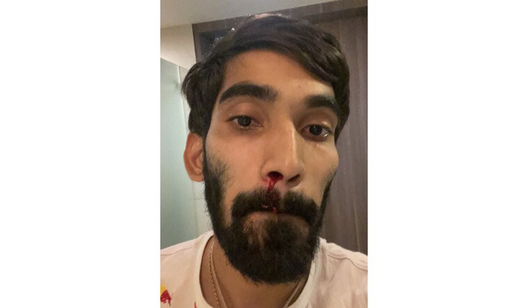 Kidambi Srikanth shared the image of his bloodied nose on social media | via Twitter/@srikidambi