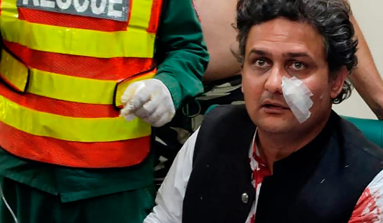 PTI leader Faisal Javed who was injured in the firing | AP