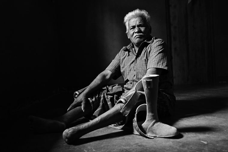 Velu Mohanraj stepped on a mine while he was hurrying through a drizzle.