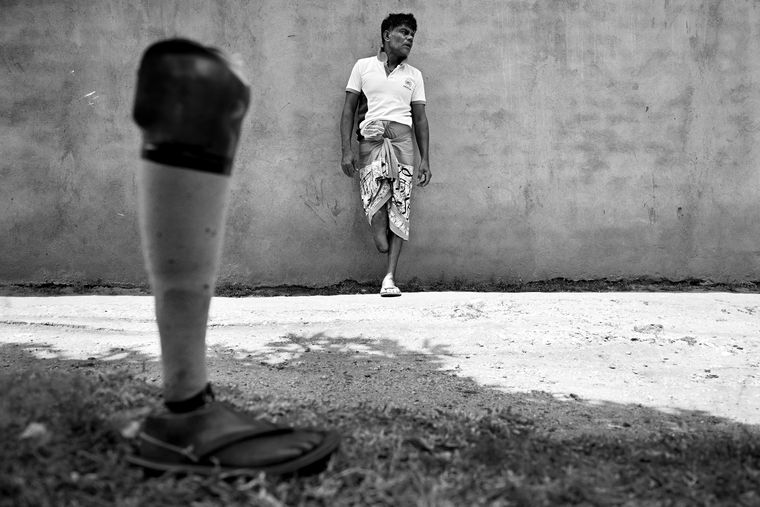 T.N. Wimalasiri, a soldier injured during Operation Jayasikurui in 1998. He lives on a modest pension and the income from his fruit stall.