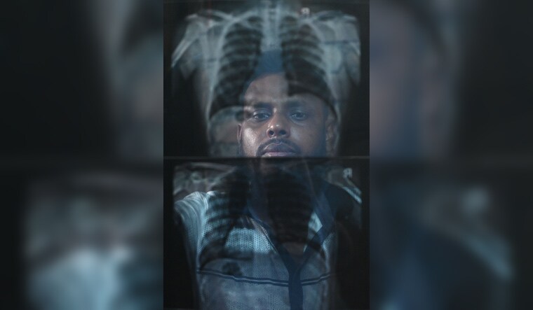Trauma on film: Mob attack victim Najir Hosain with his X-Ray | Salil Bera