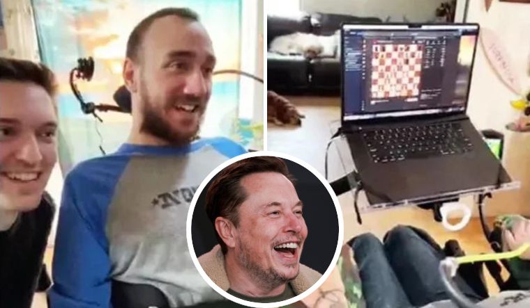 In the video, the 29-year-old quadriplegic man, Noland Arbaugh, is seen playing online chess after being implanted with a brain chip of Neuralink founded by Elon Musk | X/Reuters
