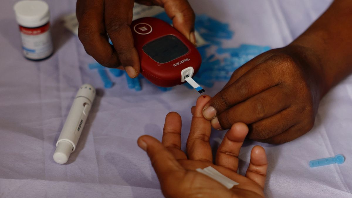 New Type 5 diabetes: New form of disease linked to malnutrition affects millions of kids worldwide New Type 5 diabetes: New form of disease linked to malnutrition affects millions of kids worldwide