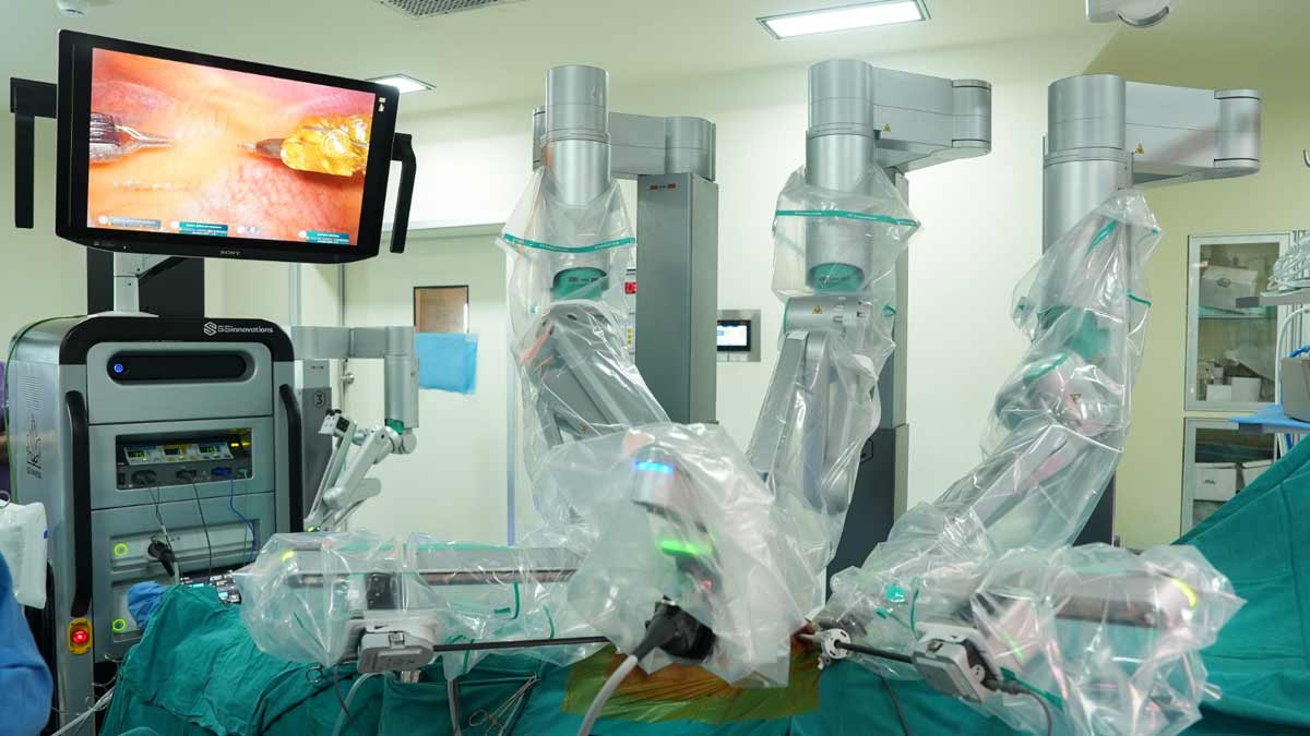 SSI Mantra 3 Surgical Robotic System