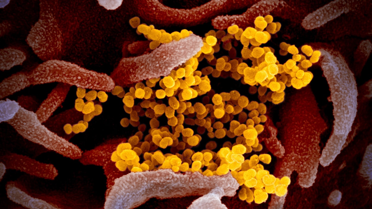 hmpv-virus-ap